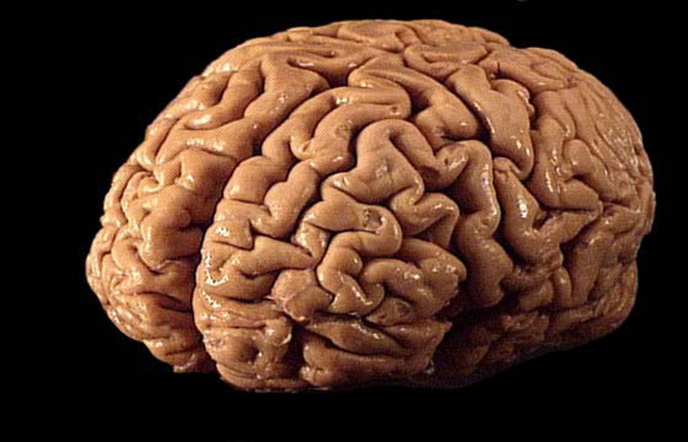 David Eagleman / Brain Self