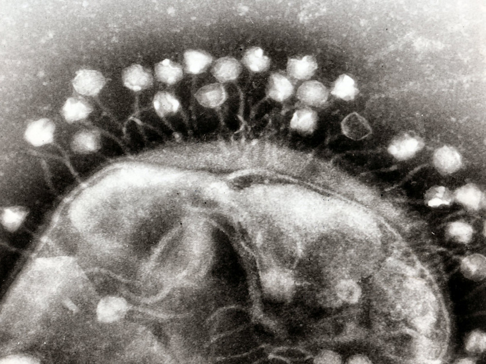 Strathdee & Patterson / Phage Therapy