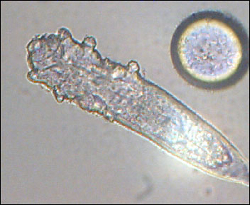 Michelle Trautwein / Face Mites