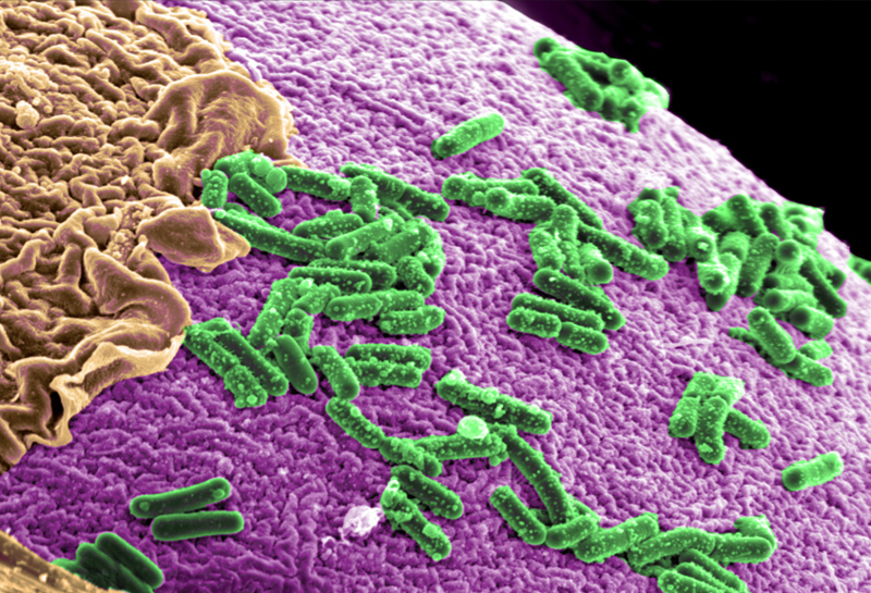 Thomas McDade / Our Microbe Guardians