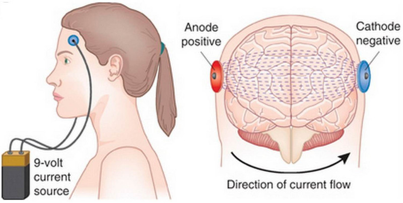 Anna Wexler / TDCS Risks